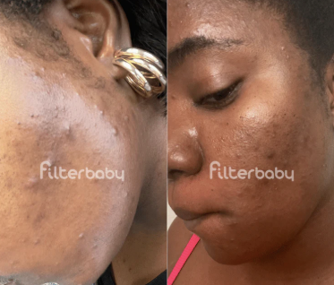 Naledi K., Johannesburg